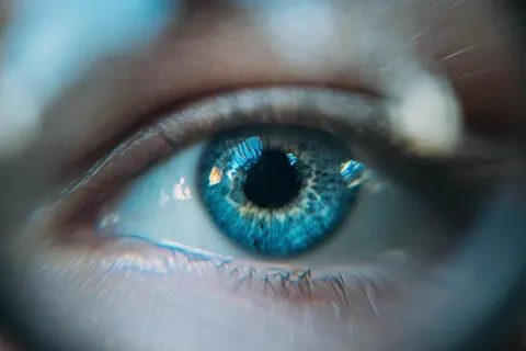 Axion Eye